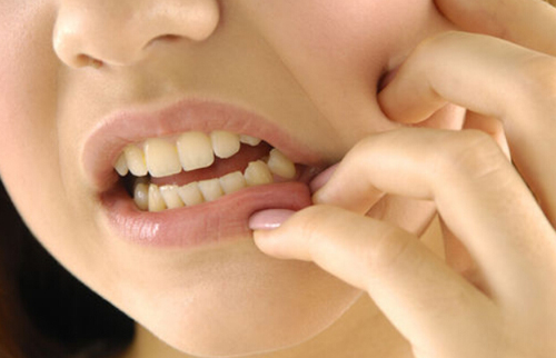 Mẹo giảm đau nhức khi mọc răng khôn