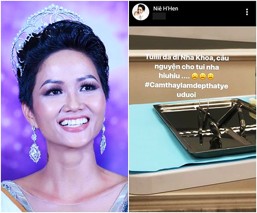Hoa hậu Hoàn vũ Việt Nam 2017 - H'Hen Niê cũng quan khá quan tâm đến thẩm mỹ nha khoa