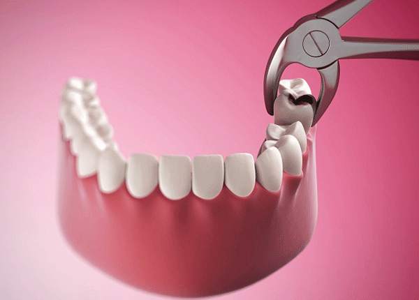 Giải đáp những câu hỏi về răng miệng thường gặp