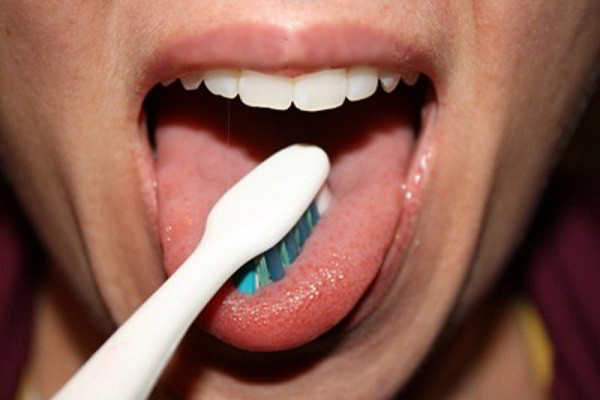 Vì sao cần vệ sinh lưỡi mỗi ngày?