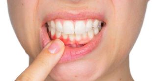 Giải đáp những thắc mắc về vấn đề răng miệng thường gặp