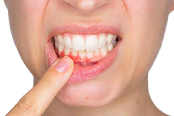  Giải đáp những câu hỏi về răng miệng thường gặp
