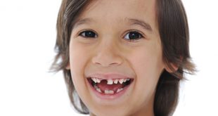 Trẻ chậm thay răng sữa thành răng vĩnh viễn là do đâu?