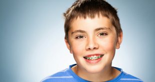 Nhận biết sớm tình trạng hô răng ở trẻ và cách xử lý