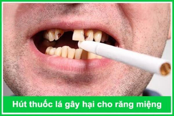 Thuốc lá gây ra những vấn đề răng miệng nào nghiêm trọng?