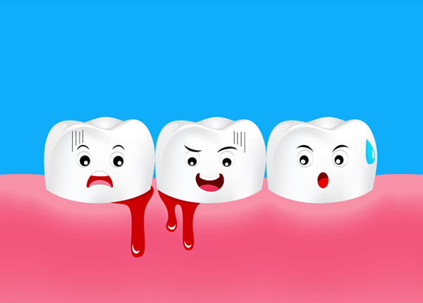 Chảy máu chân răng xuất phát từ các mảng bám tích tụ