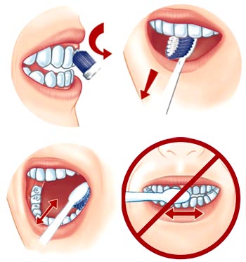 Hãy đánh răng đúng cách để góp phần bảo vệ sức khỏe răng miệng