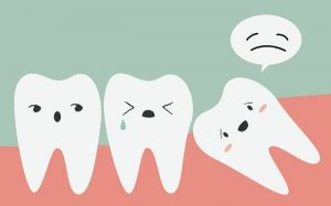 Khi răng khôn mọc lên có những biến chứng nào?