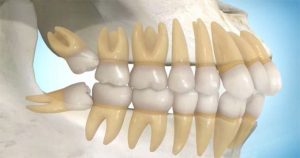  Chiếc răng số 8 để lại hậu quả khôn lường tơi sức khỏe của bạn 
