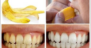 Bật mí 7 mẹo giúp đánh bay các vết ố vàng trên răng
