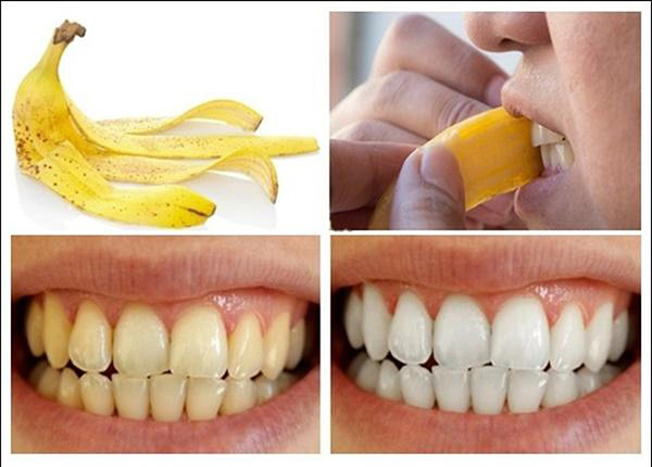 Những phương pháp giúp hàm răng luôn giữ được vẻ trắng sáng