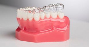 Hiểu rõ hơn về phương pháp niềng răng trong suốt hiện đại