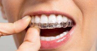 Hướng dẫn cách chăm sóc răng miệng sau khi tháo niềng