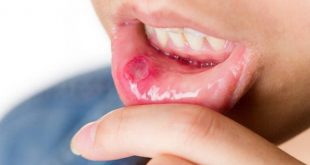 Mối liên quan giữa sức khỏe răng miệng và sức khỏe tổng thể