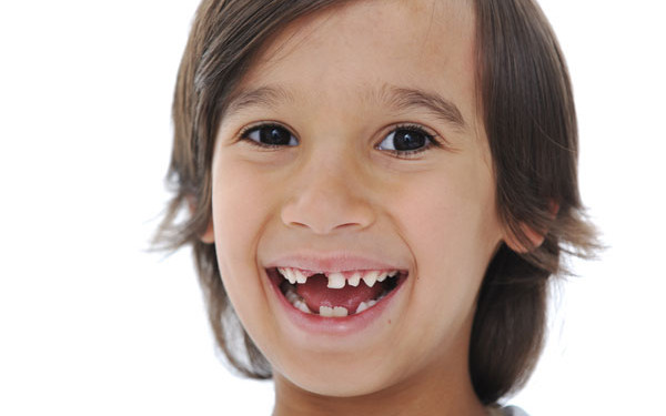 Nguyên nhân khiến trẻ thay răng chậm