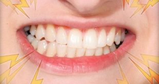 Bật mí các phục hồi men răng hiệu quả mà không cần tới nha khoa