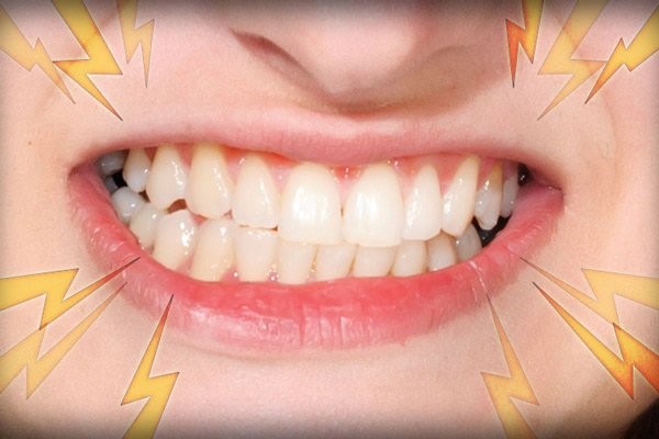 Phục hồi men răng hiệu quả ngay tại nhà