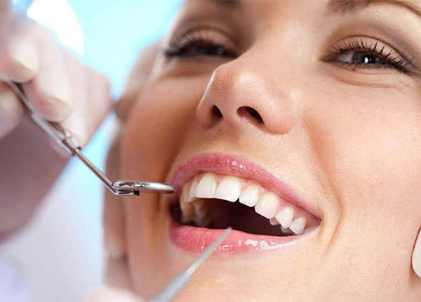 Lấy cao răng có tác dụng phòng ngừa các bệnh răng miệng, giúp răng trắng sáng