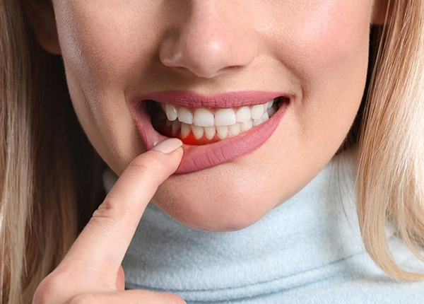 Chảy máu chân răng liên tục có thể do các bệnh lý nguy hiểm tiềm ẩn